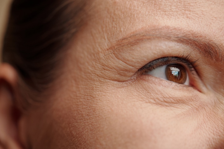 eye wrinkles and skincare